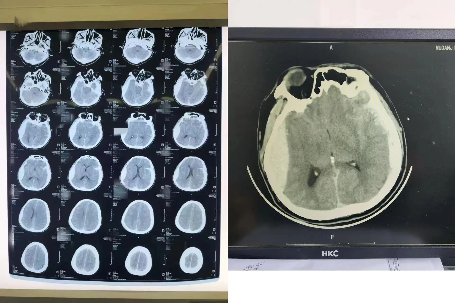 65d550c6e8209.jpg 65d550c6e8209.jpg