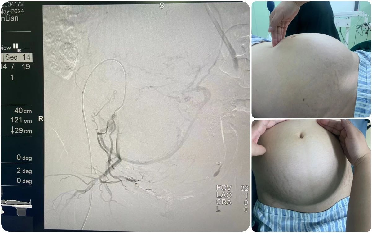 666936468d191.jpg 666936468d191.jpg